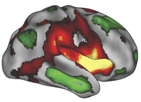 The Imagination Network of The Brain - Creative Cognition